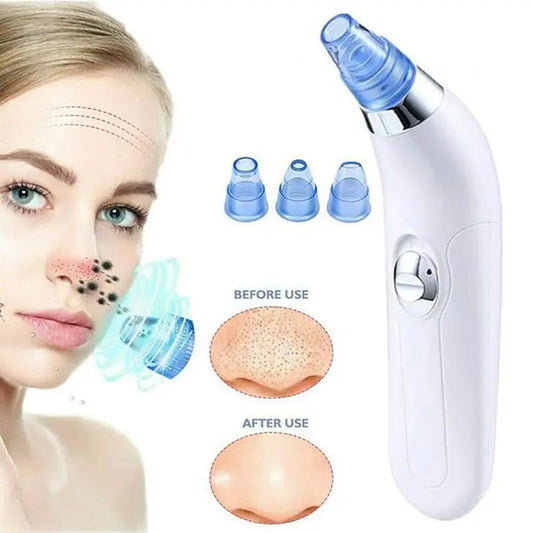 Blackhead Removal Machine