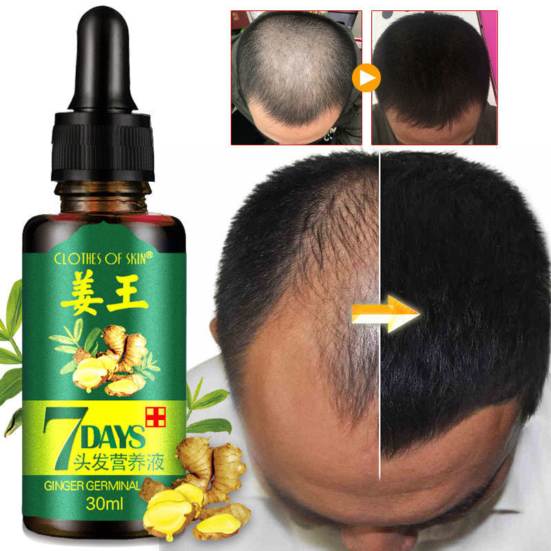 Hair Growth Serum